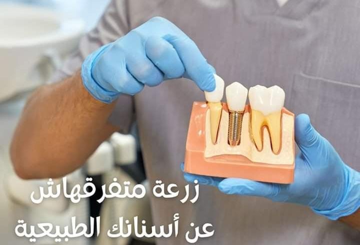 زراعة الأسنان