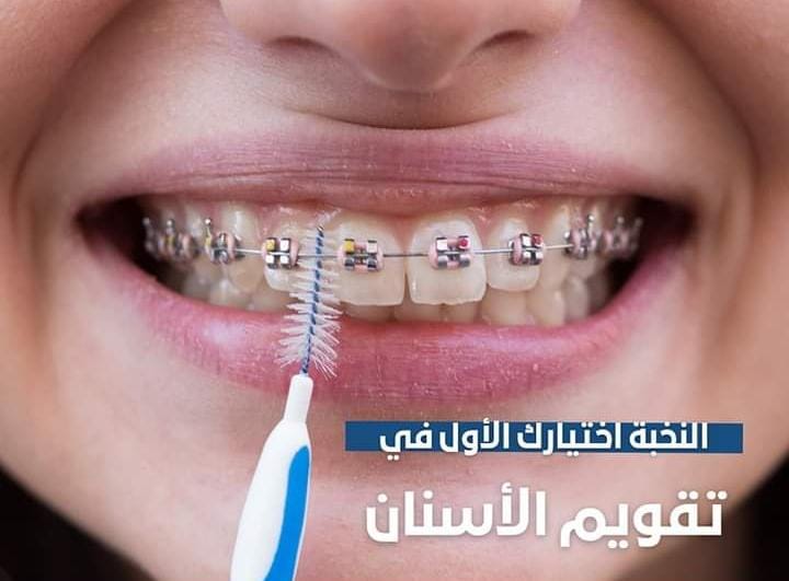 تقويم الاسنان